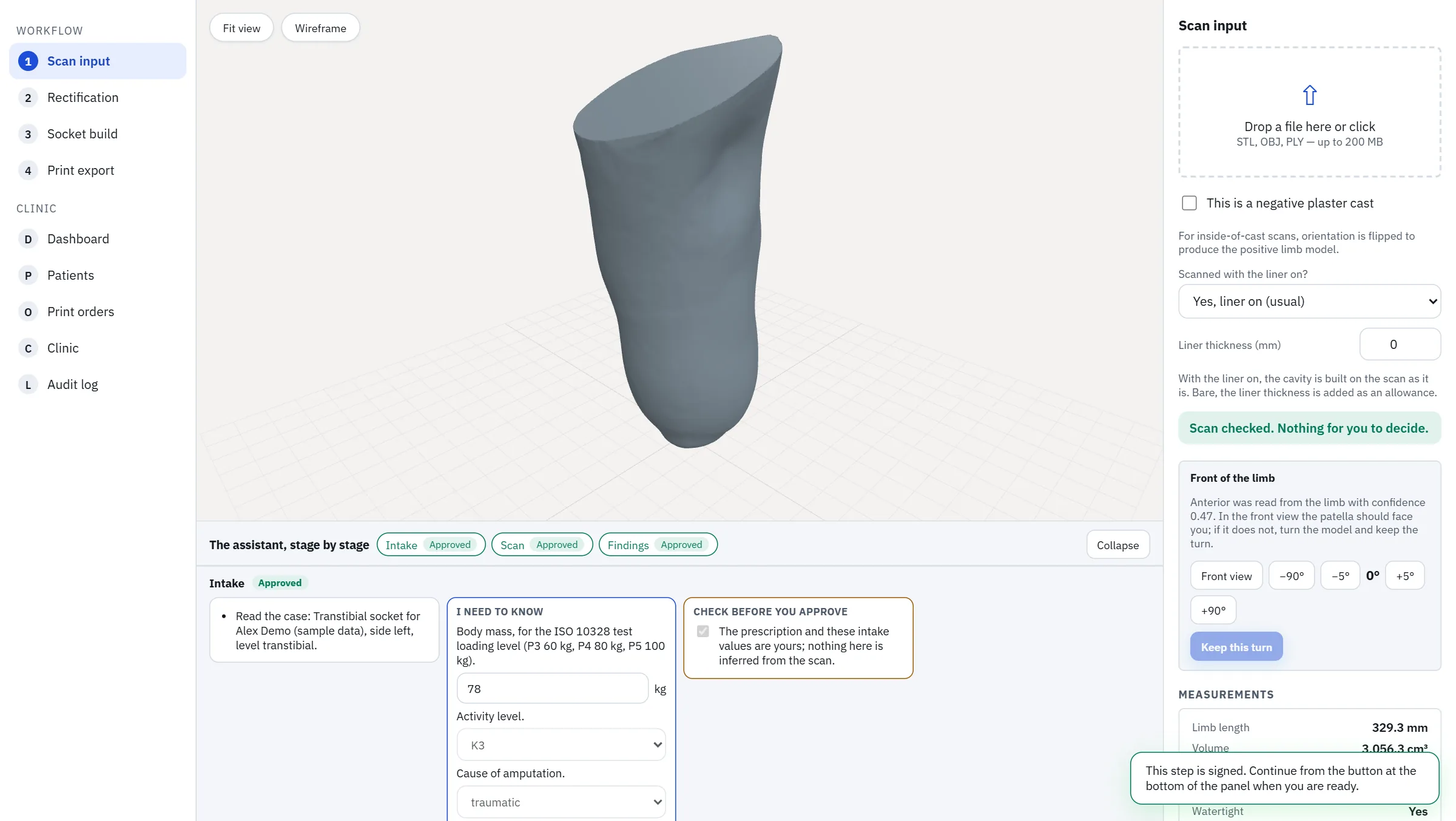 Socket Studio at the scan step: the limb in the viewer, the scan check and the measurements beside it